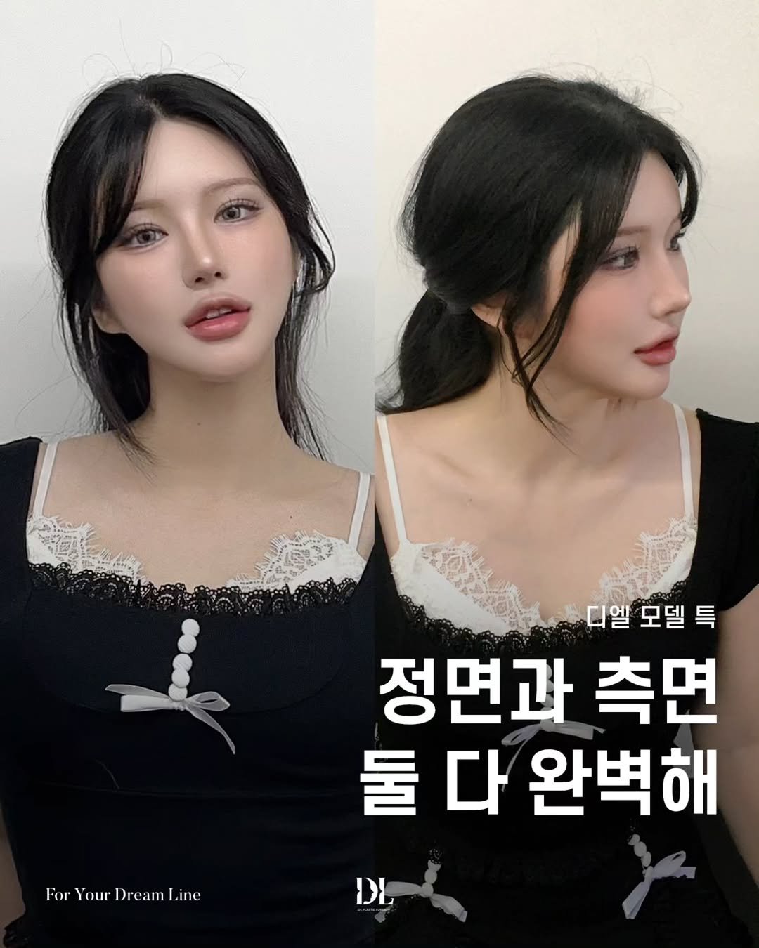 Photo by 디엘성형외과 | 최적의 프로필라인 설계 on February 19, 2026. May be an image of one or more people, hair and text that says '디엘 모델 디엘모델특 특 정면과 측면 둘 다 완벽해 For ForYourDreamL.ine Your Dream YourDream Line DE'.