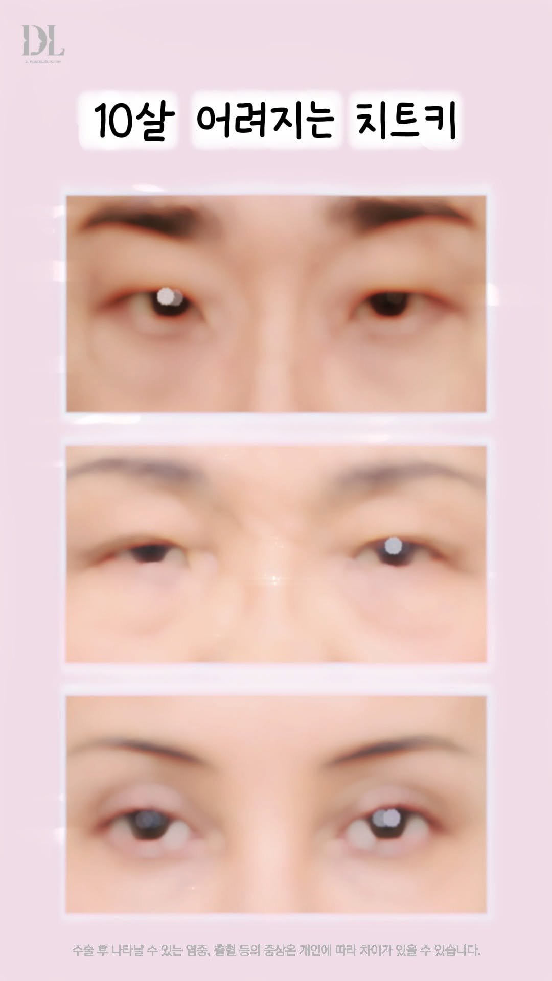 dl_plastic_official 게시물 이미지: '이것'만 없애도 10살 어려진다? 동안의 비결이 궁금한 분들은 댓글에 '치트키'를...