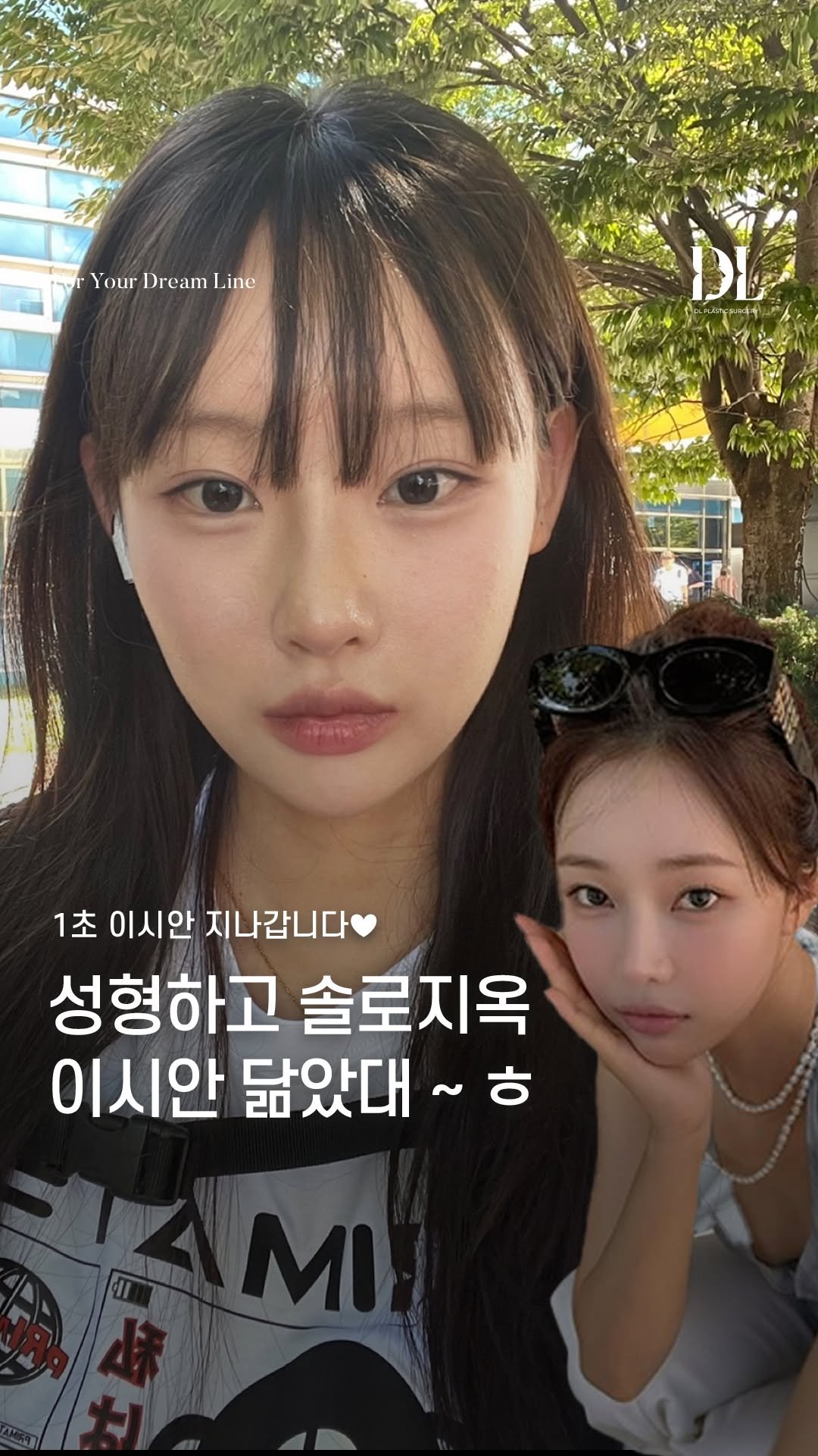 dl_plastic_official 게시물 이미지: #정보공유 성형하고 이시안 닮은 꼴이 된 성형정보가 궁금하다면 댓글에 "궁금해"...