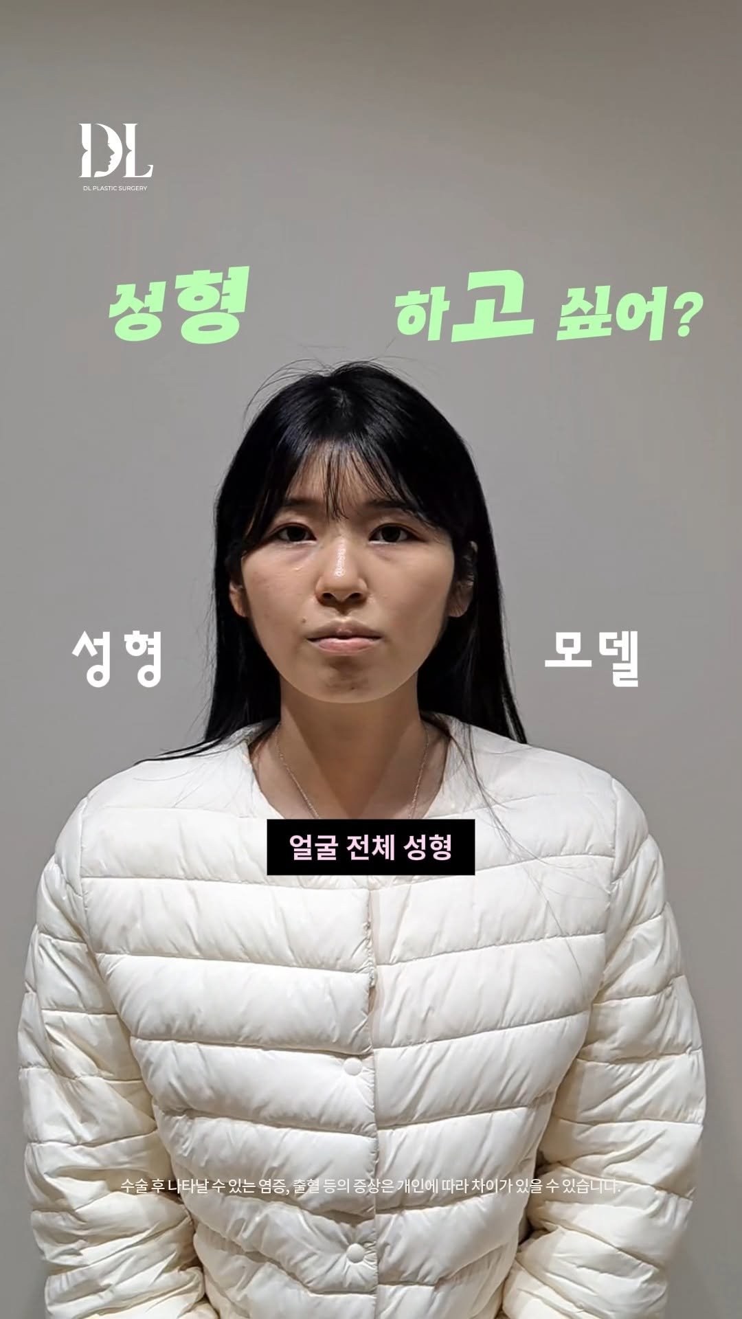 dl_plastic_official 게시물 이미지: #정보공유 얼굴 싹 바뀐 성형 정보가 궁금하다면 "성형할래"라고 댓글...