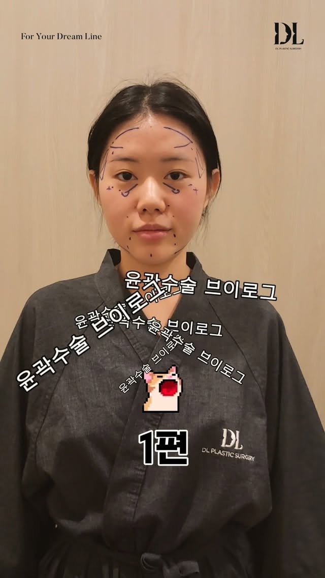dl_plastic_official 게시물 이미지: 윤곽수술 뿌이로그 1편 🧚🏻‍♀️ 수술 정보가 궁금하다면 ‘디엘’이라고 남겨주세요!