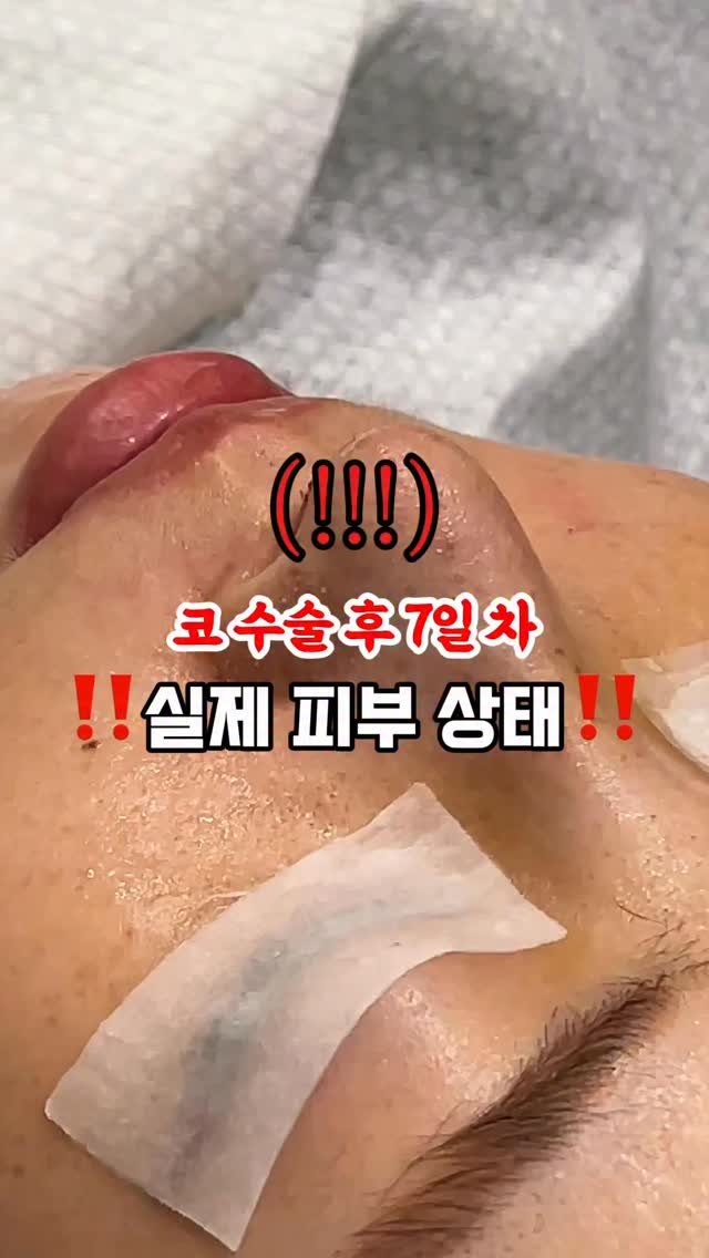 doctorhan_edition 게시물 이미지: 거울을 보니 나도 각질 케어?🔻투표🔻

댓글에 ’각질에디션‘ 적어주시면 정보...