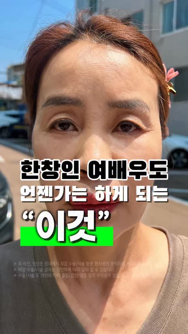 doctorhan_edition 게시물 이미지: 실리프팅❌레이저❌쌍수❌ 댓글에 ”여배우“ 적어주시면 정보 공유해 드릴게요.
...