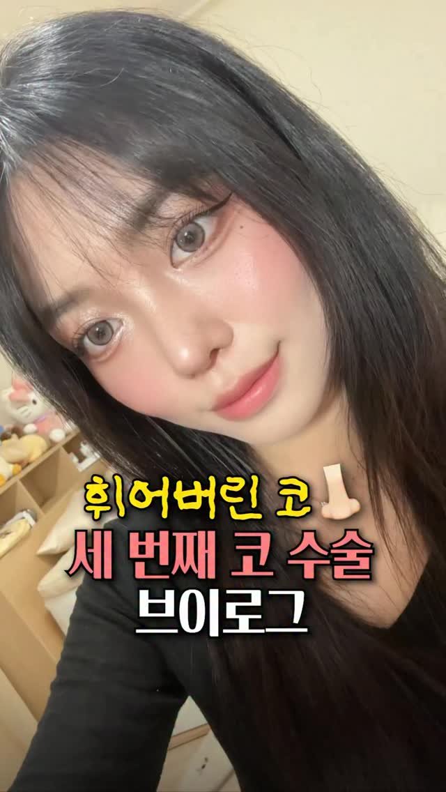 doctorhan_edition 게시물 이미지: 3번째 코 재재수술 #삼트코
　　　
타병원에서 재수술까지 하셨지만.. 육안으로도...