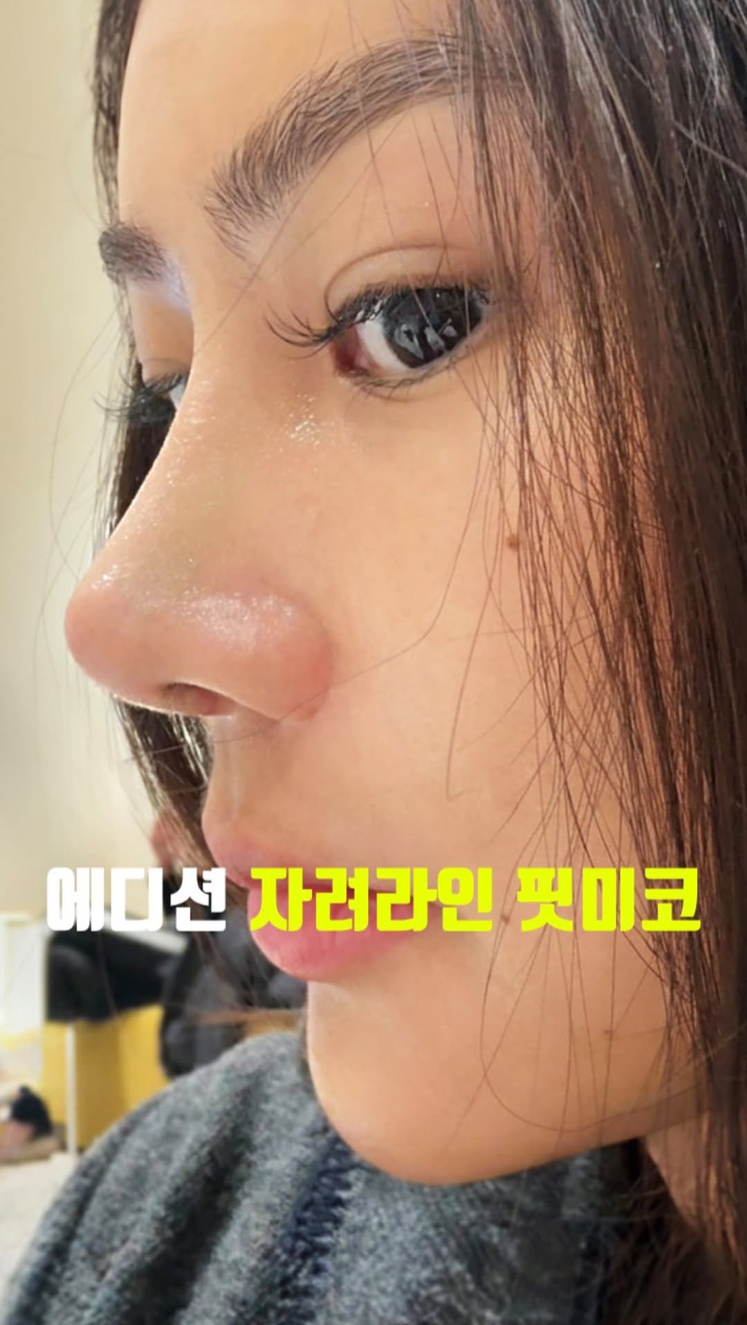 doctorhan_edition 게시물 이미지: 라인이 먼저 보이는 코

댓글에 ’코‘ 남겨주시면 
자세한 정보...