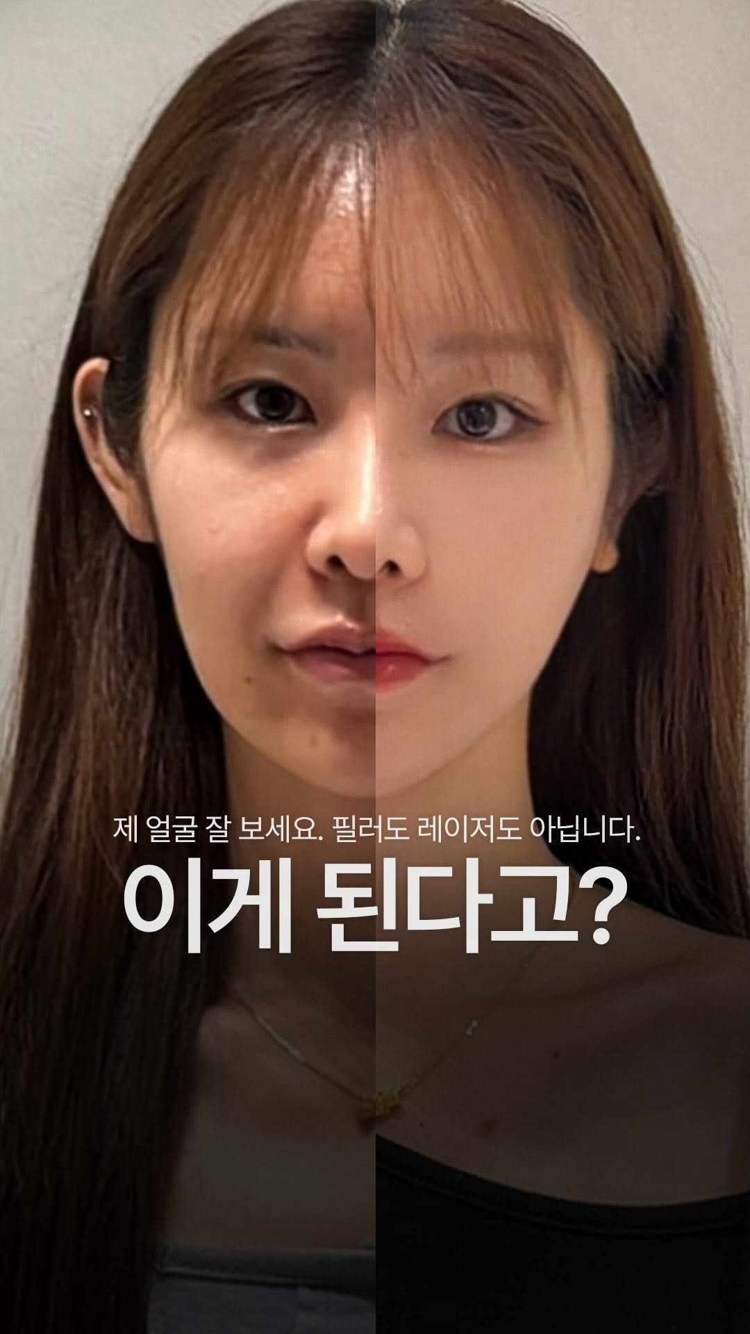 doctorhan_edition 게시물 이미지: 필러도 레이저도 아닌데, 
왜 이렇게 달라졌을까요?

생각보다 얼굴 변화는
단순히...