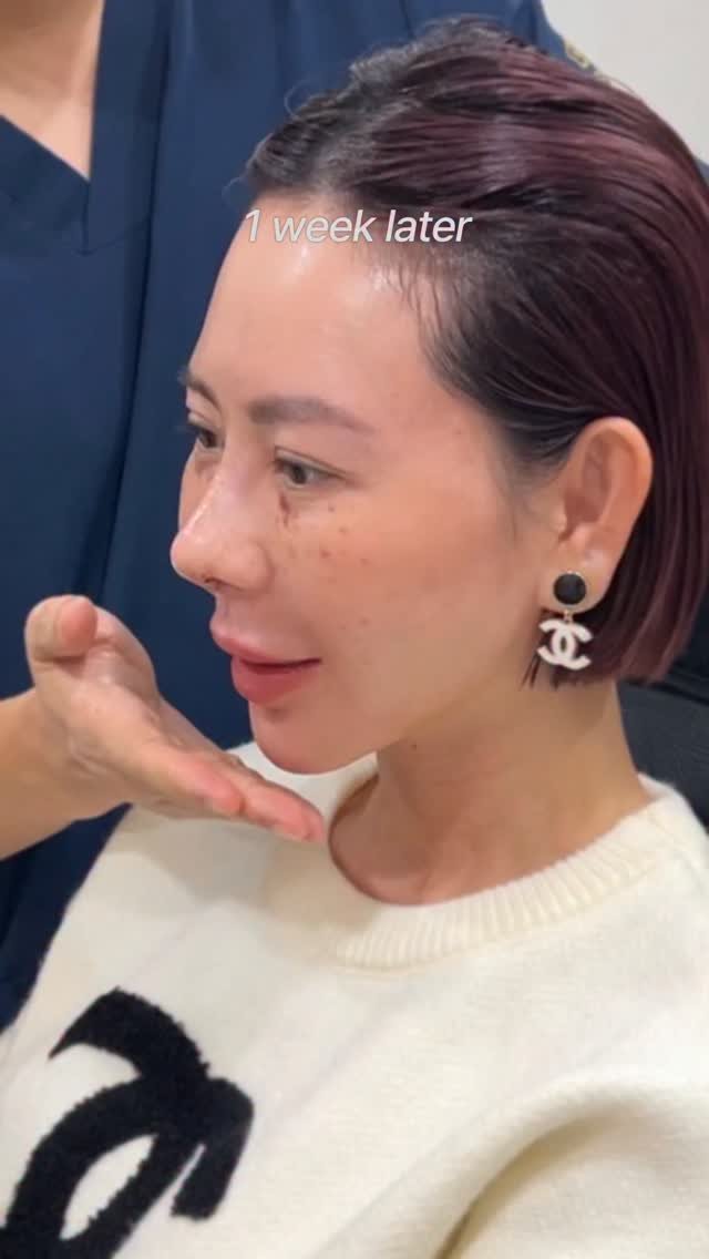 doctorhan_edition 게시물 이미지: “이번에도 또 안 되면 어쩌지”라는 말부터 시작했습니다.

5번째 재수술.
그리고...