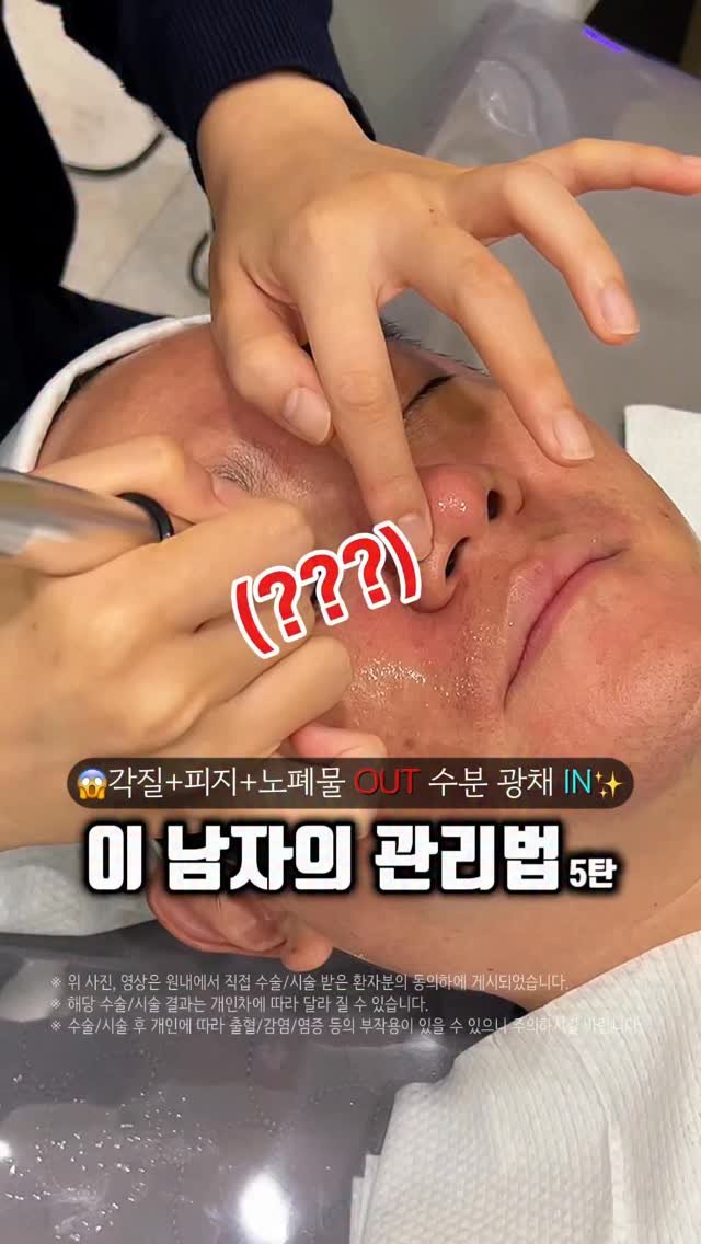 doctorhan_edition 게시물 이미지: 왜 다들 이거 하는지 알겠음... 댓글에 ‘모공’ 적어주시면 정보...
