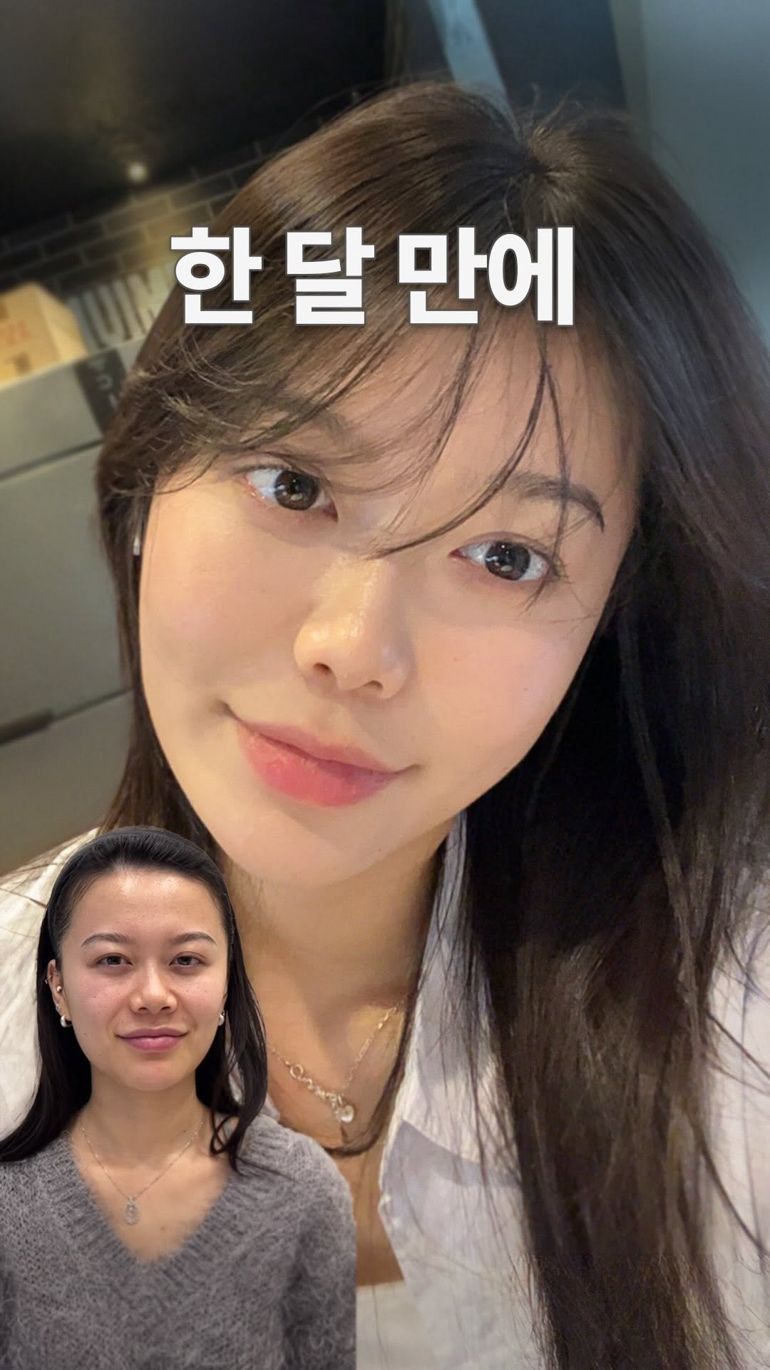 doctorhan_edition 게시물 이미지: 한 달 만에 얼굴 분위기가 달라진 이유.

한 달 전과 후를 한 화면에서 그대로...