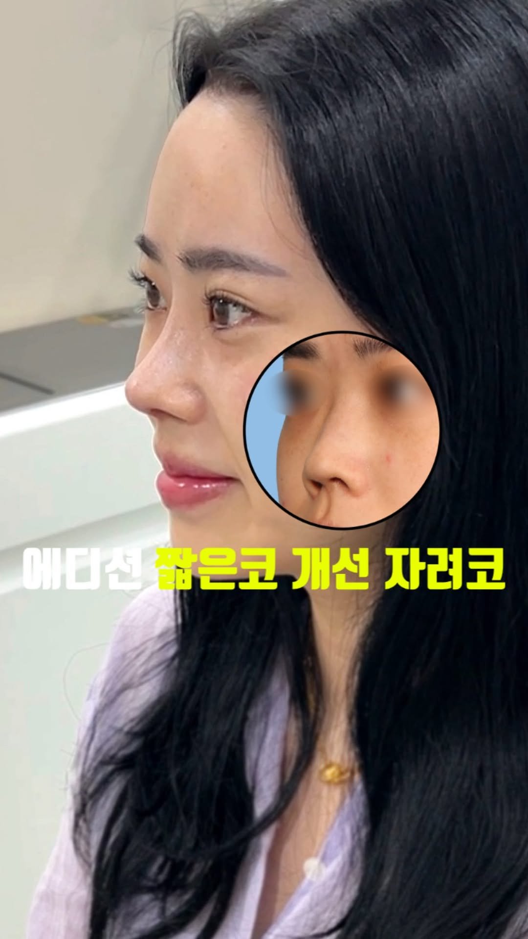 doctorhan_edition 게시물 이미지: 17초가 킬포~^^ #비포애프터 
　
댓글에 ’짧은코‘적어주시면 정보...