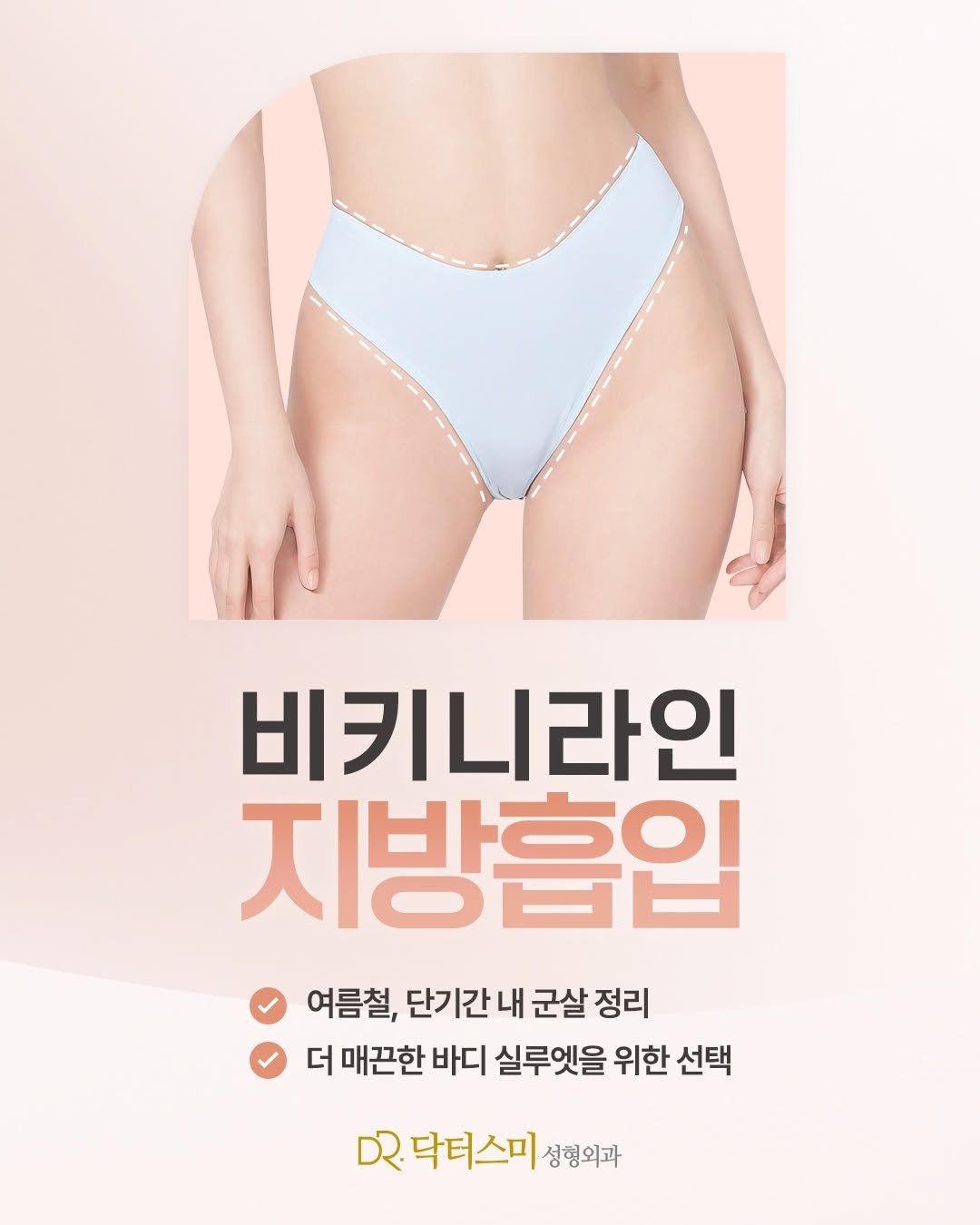 doctorsmips 게시물 이미지: 올 여름, 내가 꿈꾸던 비키니 라인을 현실로! ✨

닥터스미 성형외과의 비키니라인...
