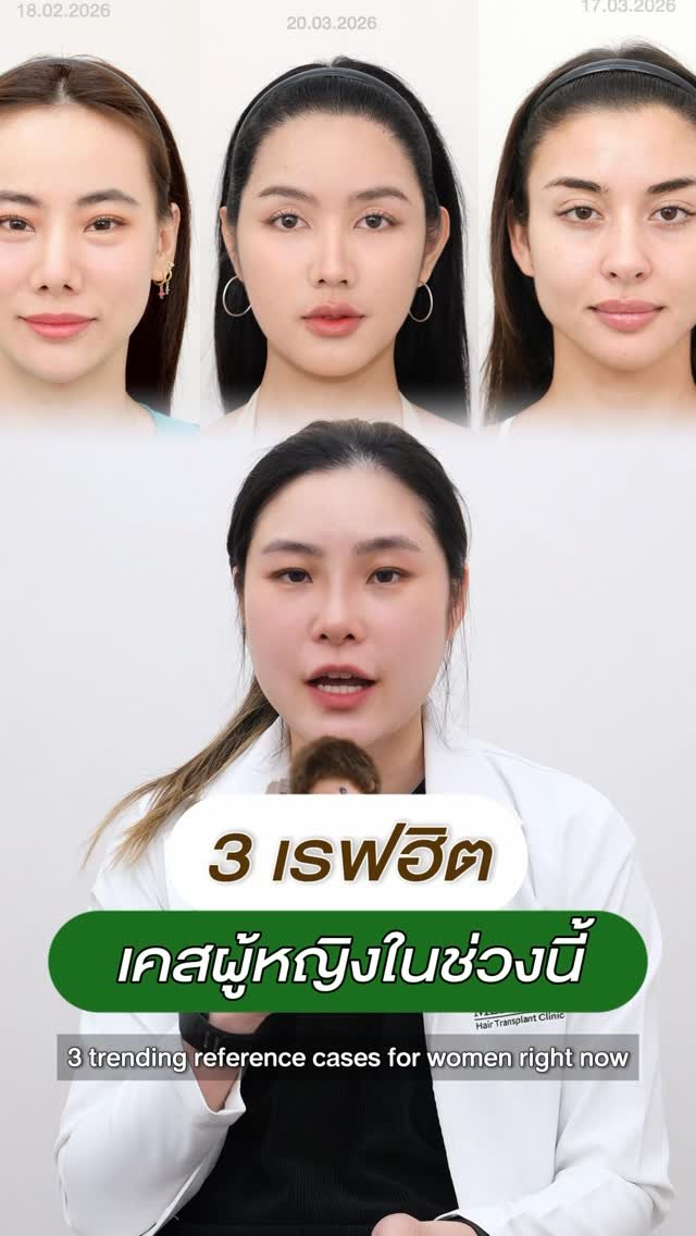 dr.aim_aphakorn 게시물 이미지: เคสปลูกผมผู้หญิง ชอบไสตล์ไหน เลือกได้เลย