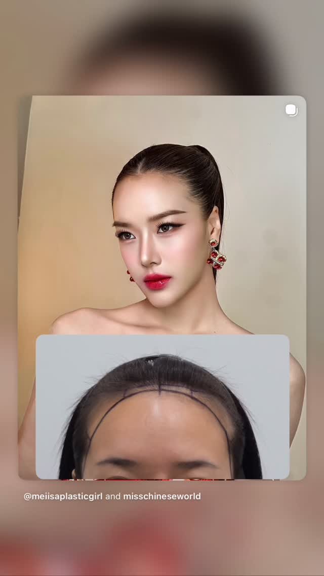 dr.aim_aphakorn 게시물 이미지: Road to miss Chineseworld 👑 #fue...