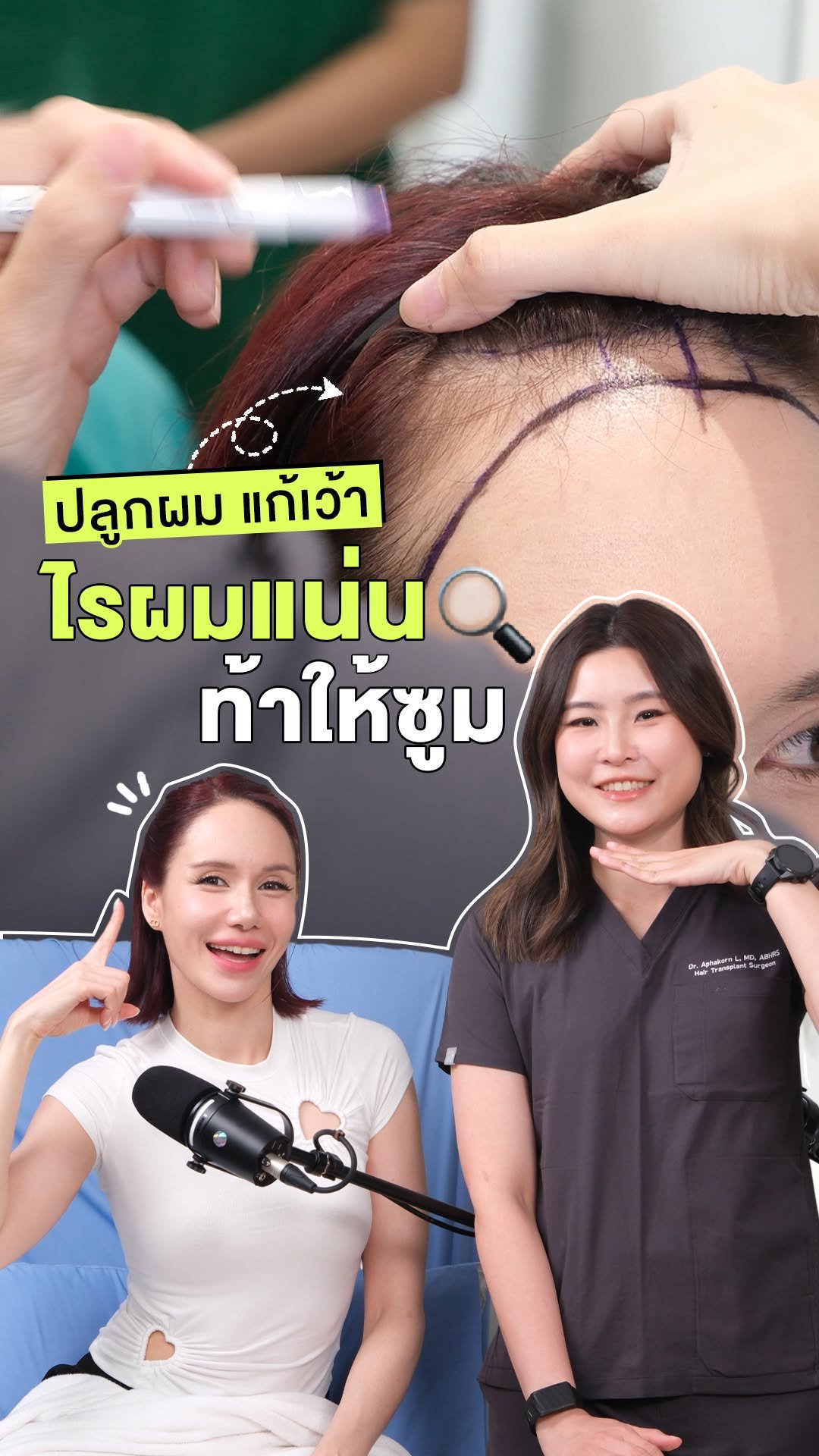 dr.aim_aphakorn 게시물 이미지: K’คุณเจน ✨ หลังปลูกผมยาวครบ 6 เดือน ผลลัพธ์ชัด...