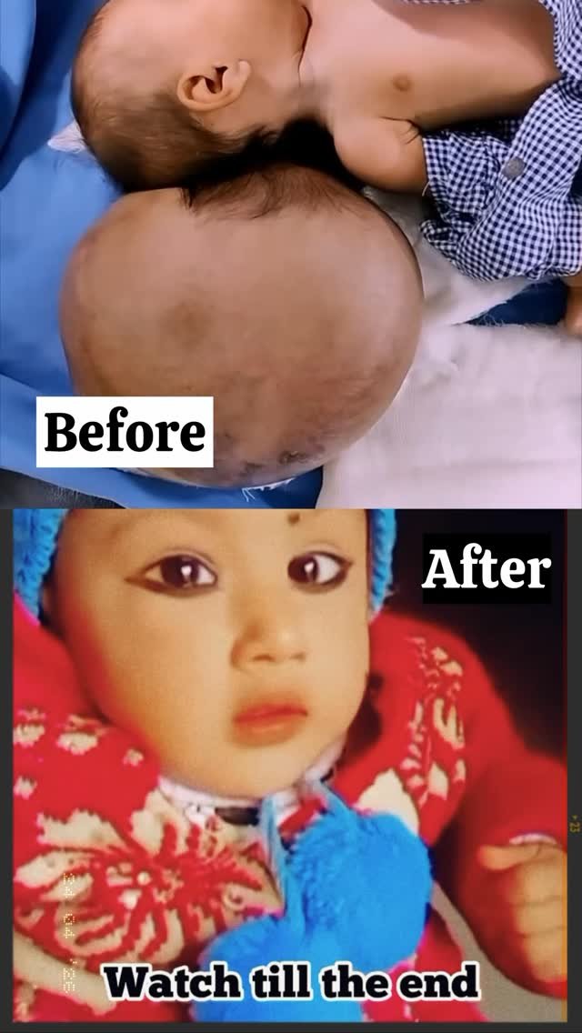 dr.amir_aiims 게시물 이미지: Some cases test your skill…
Some touch your...