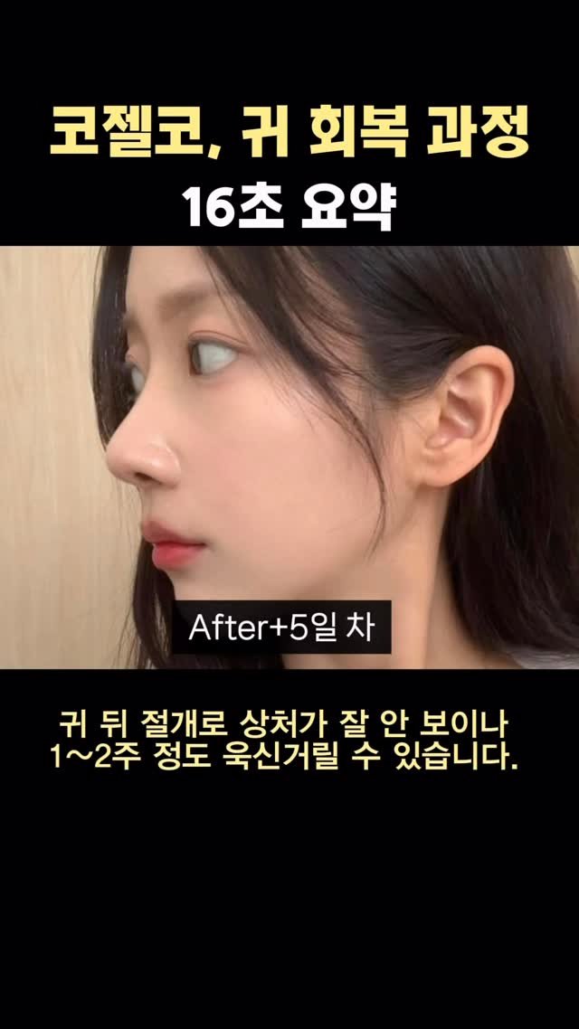 dr.by_kojel 게시물 이미지: 코젤코, 연골 채취 한 귀의 회복기간은?

안녕하세요! 코젤코의 아버지 ’닥터코젤‘...