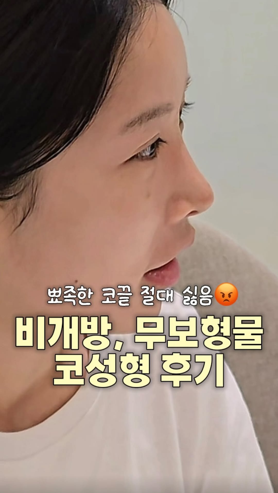 dr.by_kojel 게시물 이미지: ”코젤코처럼 자연스러운 코를 본 적이 없어요“

안녕하세요. 코젤코의 아버지...