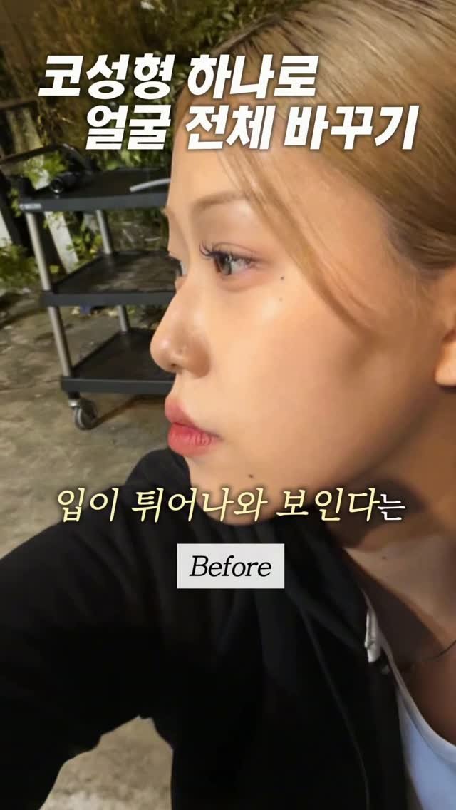 dr.by_kojel 게시물 이미지: 코성형 하나로 얼굴 전체 바꾸기

안녕하세요. 코젤코의 아버지 ’닥터코젤‘...