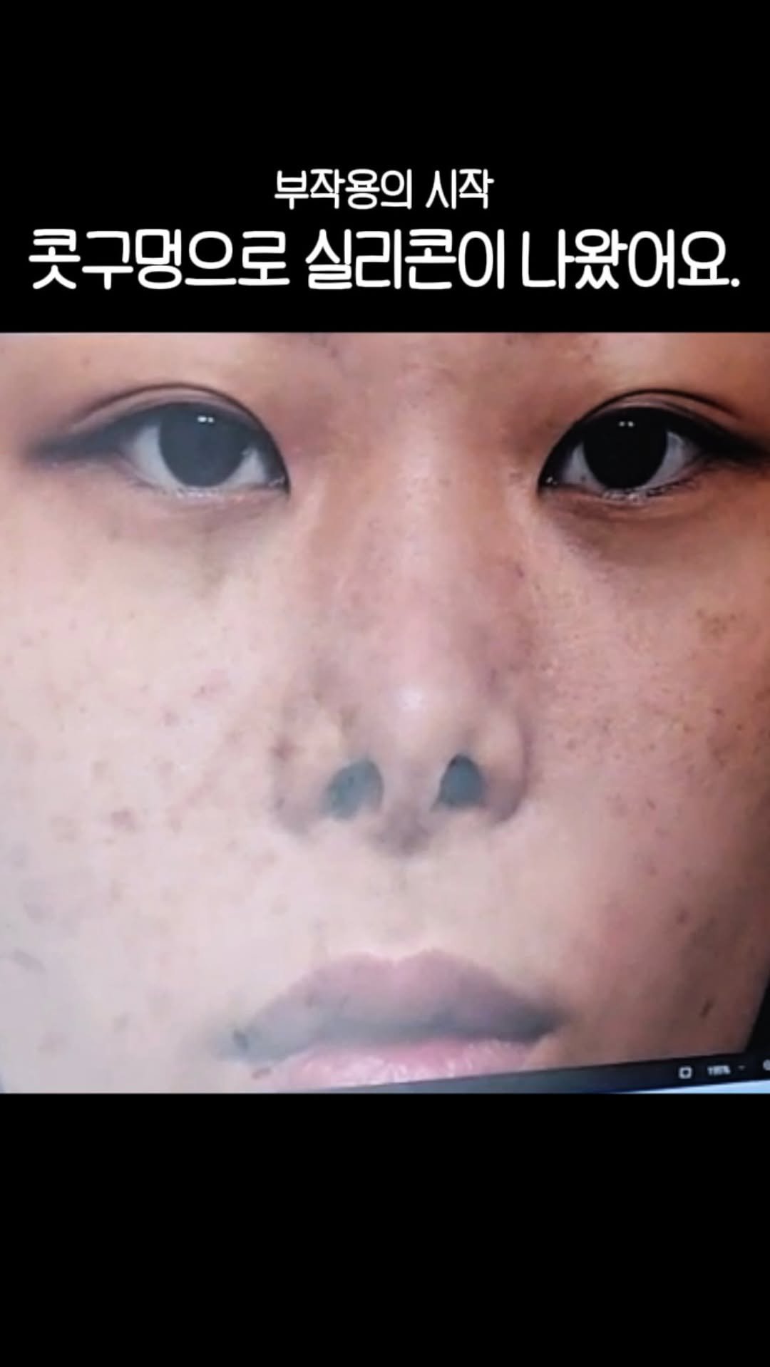 dr.by_kojel 게시물 이미지: 구축코 이전으로 돌아갈 수 있을까요?

안녕하세요! 코젤코의 아버지 ’닥터코젤‘...