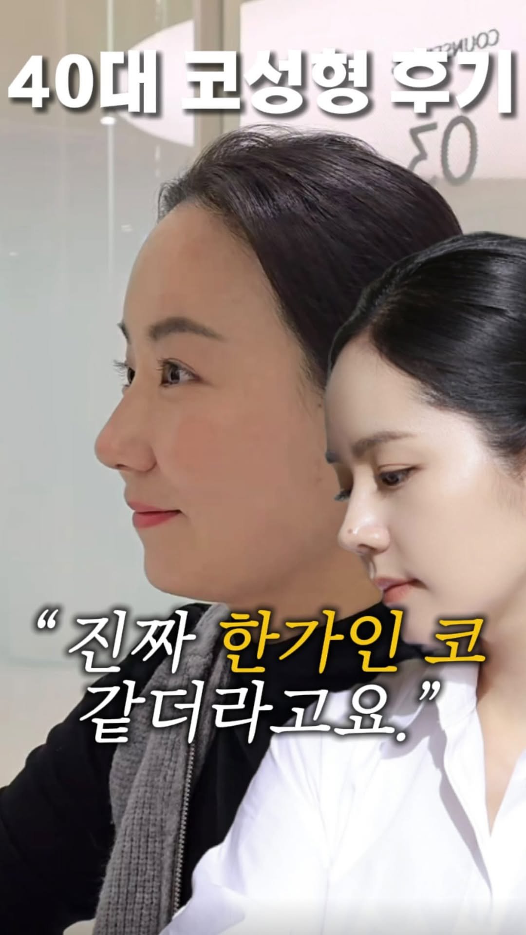 dr.by_kojel 게시물 이미지: 진짜 한가인 코가 됐는데..?

안녕하세요. 코젤코의 아버지 ’닥터코젤‘...
