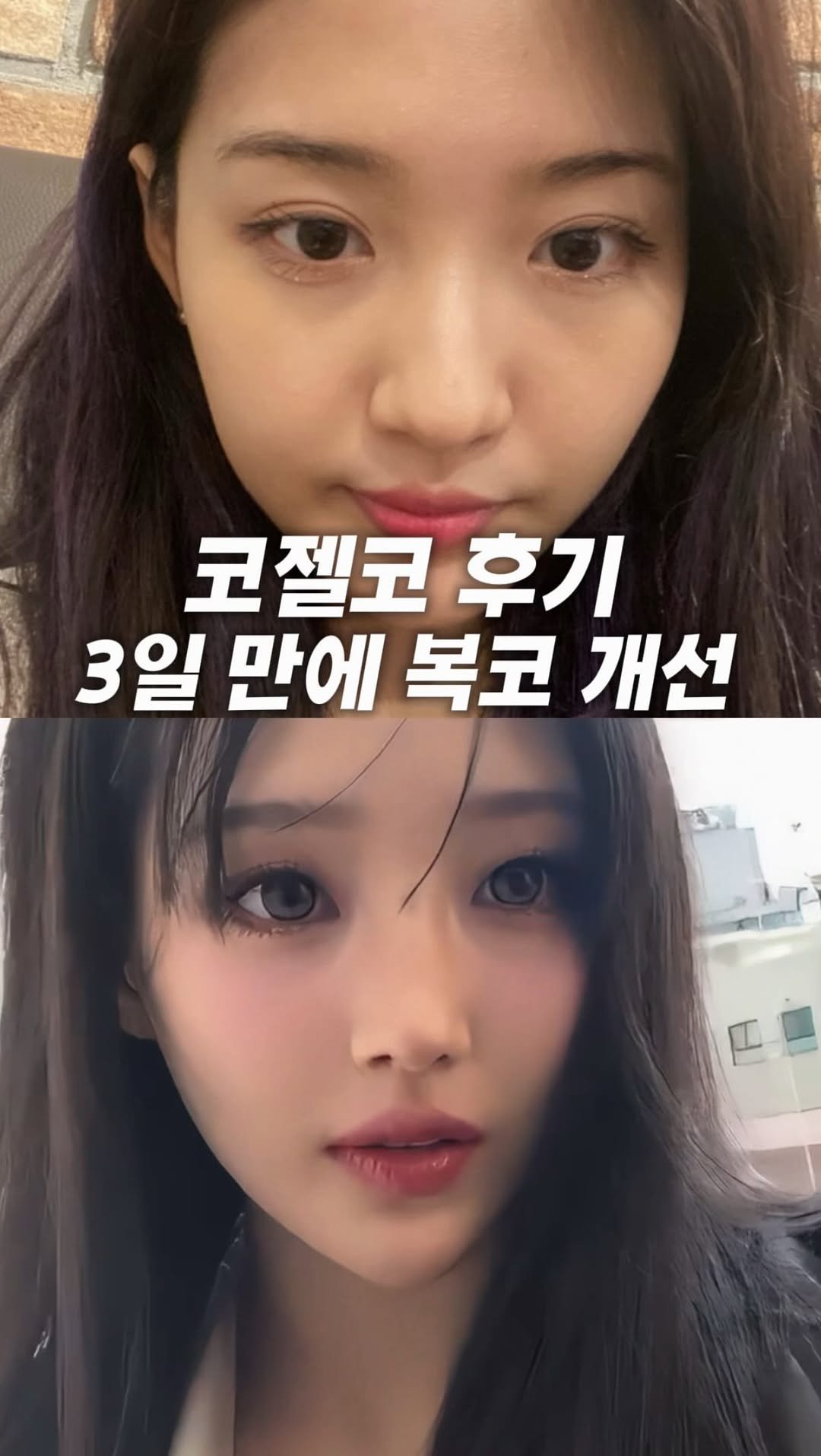 dr.by_kojel 게시물 이미지: 3일 만에 코젤코로 복코 개선하기

안녕하세요. 코젤코의 아버지 ’닥터코젤‘...