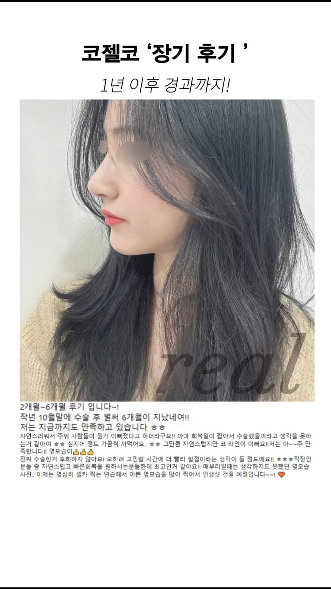 dr.by_kojel 게시물 이미지: 코젤코, 오래된 후기가 궁금하다면?

안녕하세요. ‘닥터코젤 김인상’입니다.

문득...