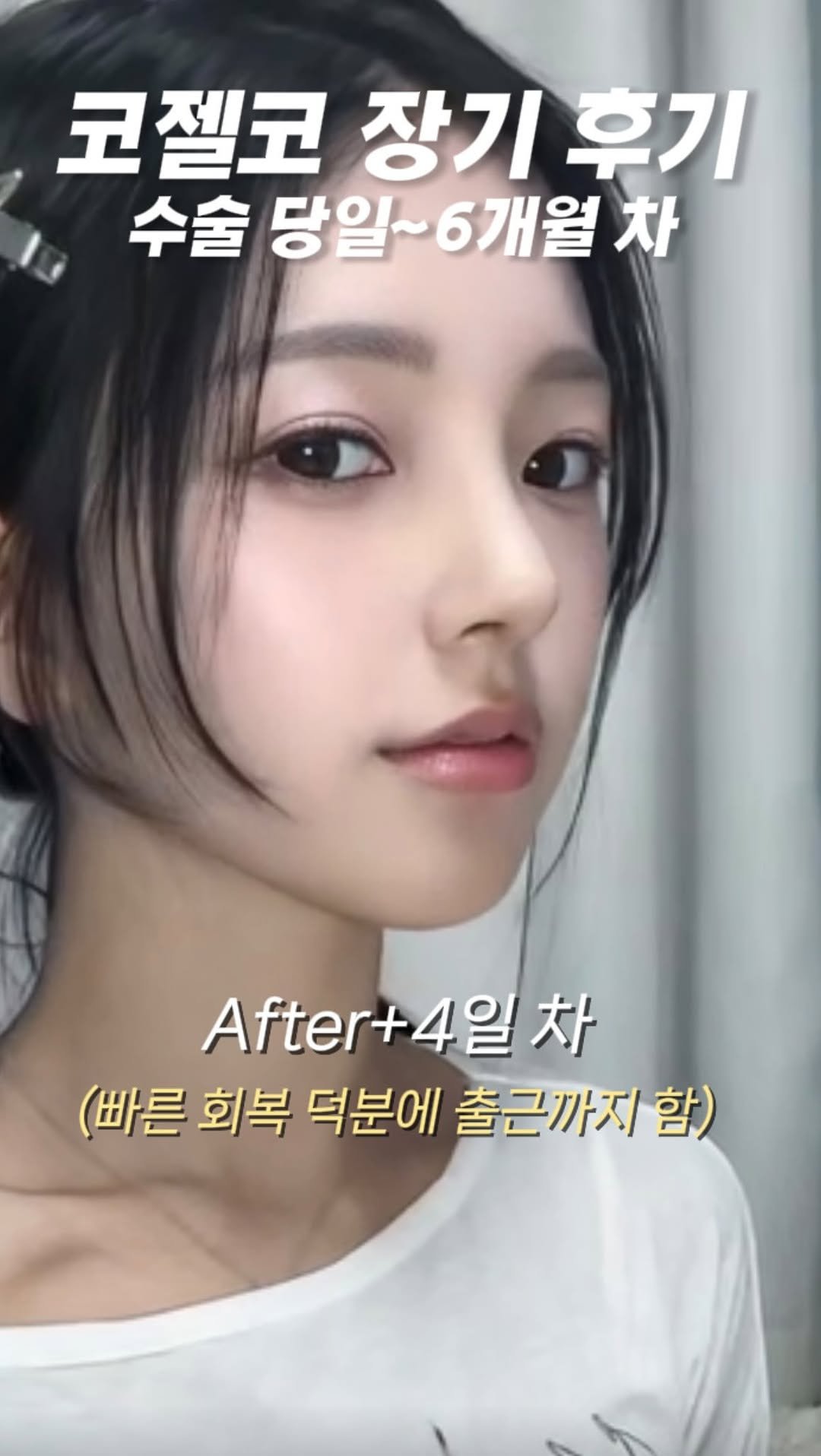 dr.by_kojel 게시물 이미지: 코젤코 장기 후기!

안녕하세요. 코젤코의 아버지 ’닥터코젤‘입니다:)!

어느덧...