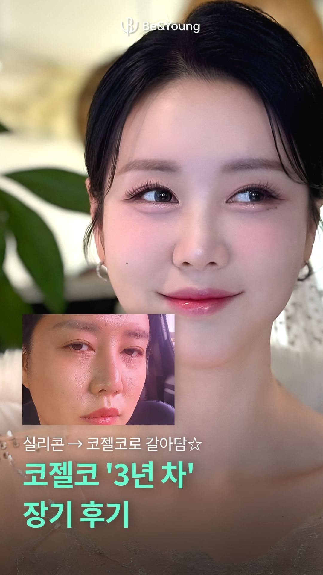 dr.by_kojel 게시물 이미지: 코젤코 장기후기 (3년 차)

안녕하세요. 코젤코의 아버지 ’닥터코젤‘...