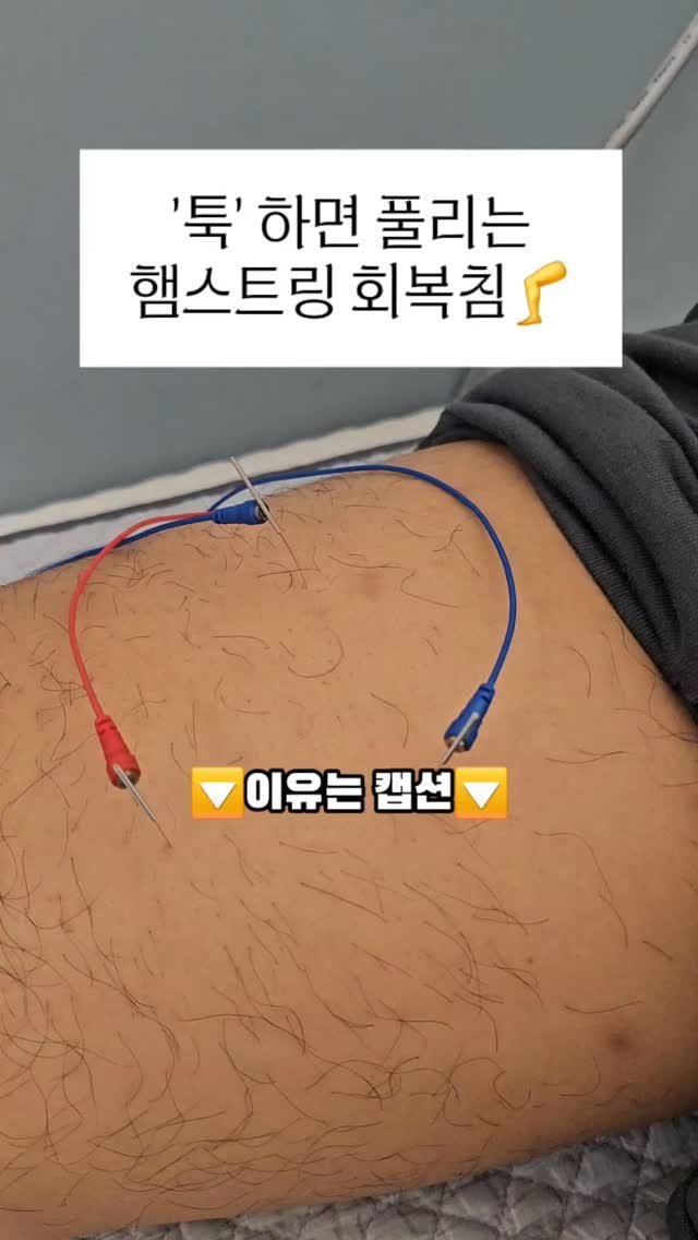 dr.chukchuk_clinic 게시물 이미지: 🦵 툭 하면 풀리는 햄스트링 회복침

운동 중, 체력시험 중,
허벅지 뒤가 ‘땅’...