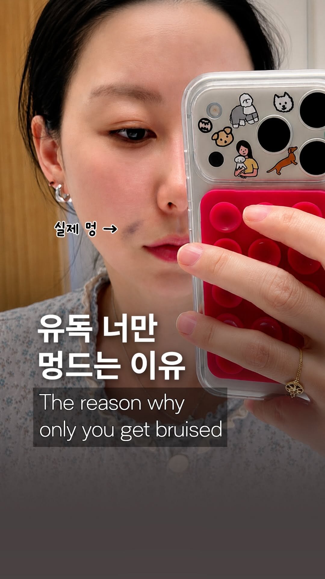 dr_ohmi 게시물 이미지: "시술·수술은 언제 받는 게 좋을까요?"

원장님은

📅 생리 끝난 후

를 가장...