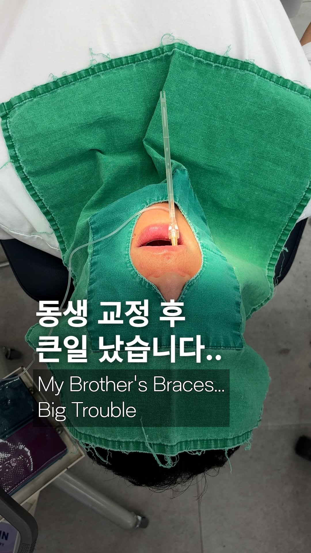 dr_ohmi 게시물 이미지: 교정 2탄 가져왔습니다 😆

지난 영상 올리고 나서
생각보다 교정 관련 질문이 정말...