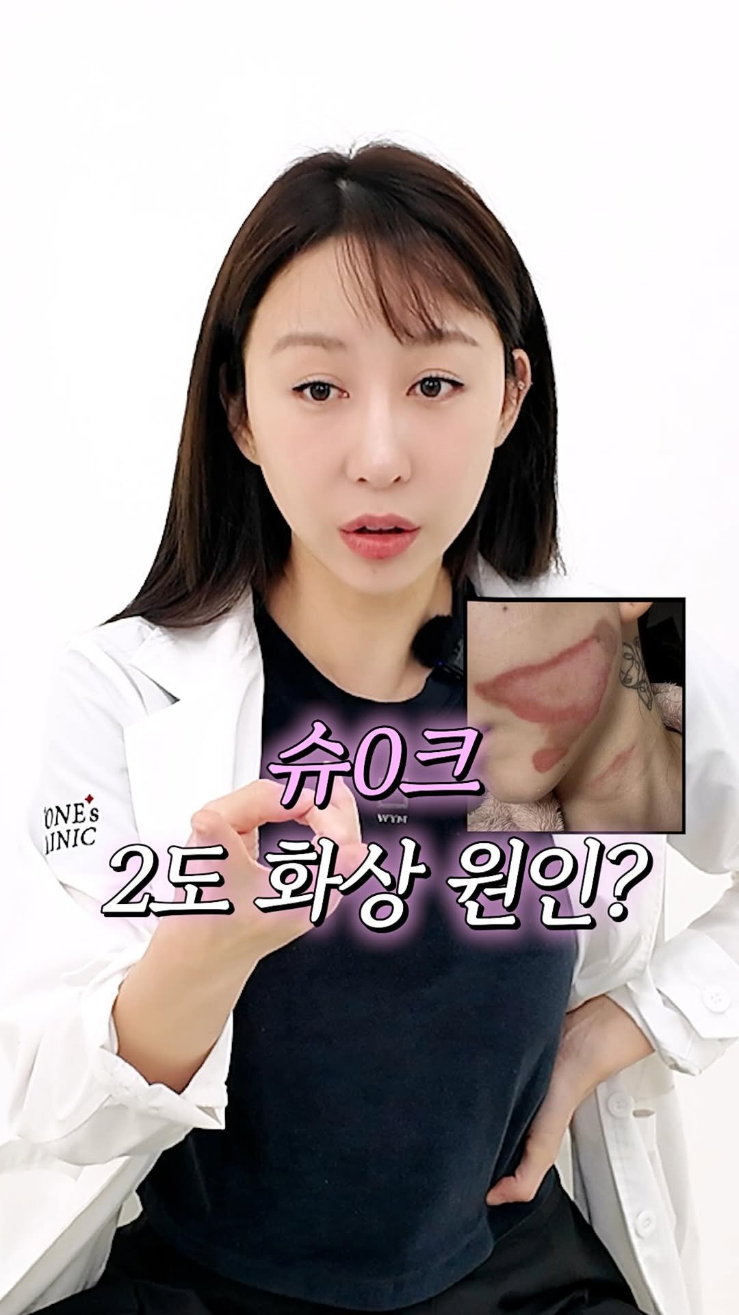 dr_ohmi 게시물 이미지: 최근 슈0크 관리 이후 화상을 입었다는 보도를 접하고,
이와 관련해 설명이...