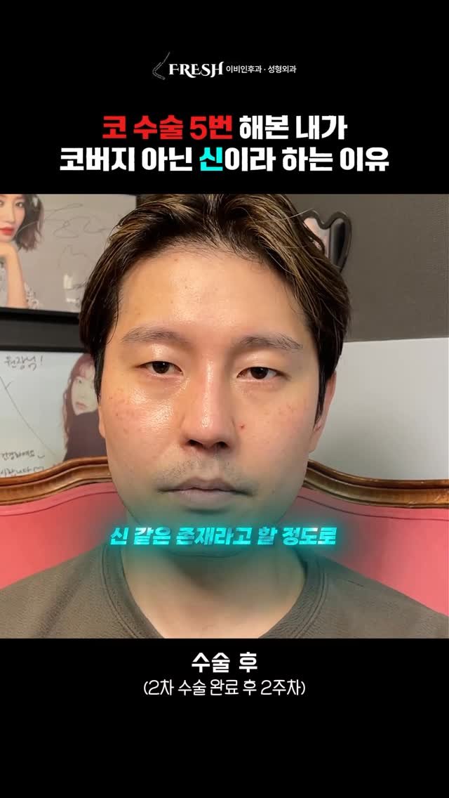 dr_taehwan_ahn 게시물 이미지: ”코 수술만 5번째... 제게 새 삶을 주셨습니다.“

타 병원에서 여러 번의...