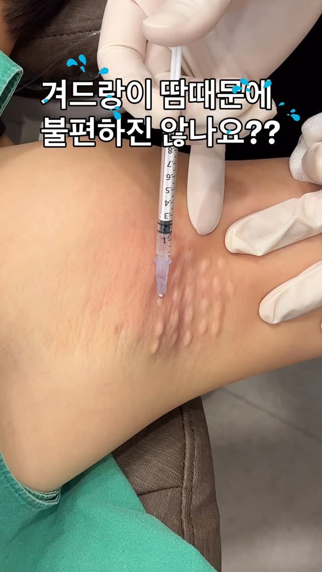 dr_yunwonseok 게시물 이미지: 겨드랑이 땀때문에 불편하진 않나요??💦