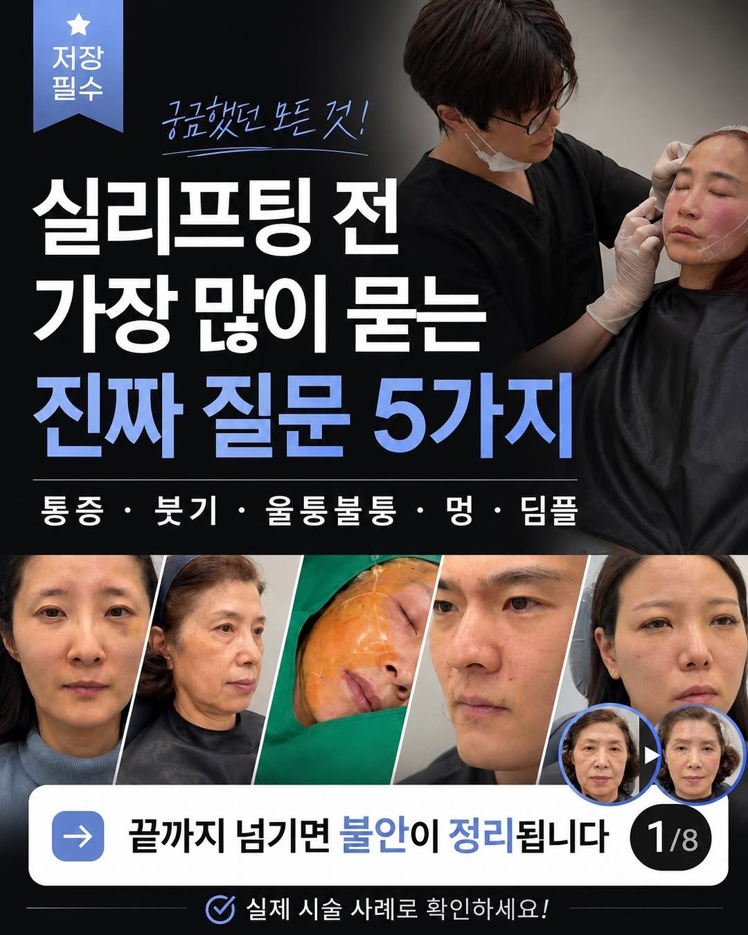dr_yunwonseok 게시물 이미지: 실리프팅 고민 중이면, 이 5가지는 꼭 알고 받으세요.

실리프팅 전 가장 많이...