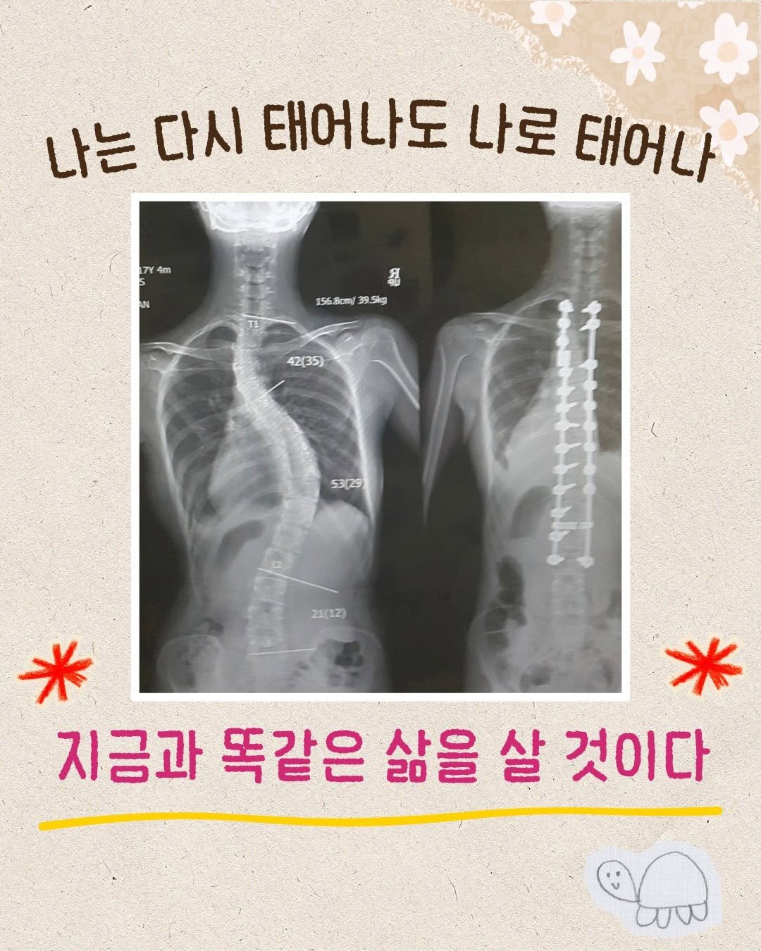 dreamooong 게시물 이미지: 나는 다시 태어나도 나로 태어나 지금과 똑같은 삶을 살것이다

그 어떤 믿음보다...