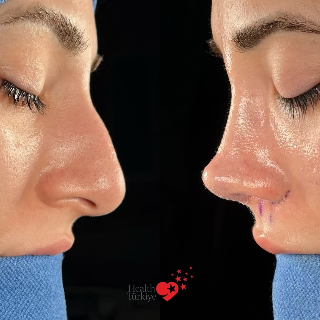 drfurkanozer 게시물 이미지: Swipe to see the transformation ➡️

This...