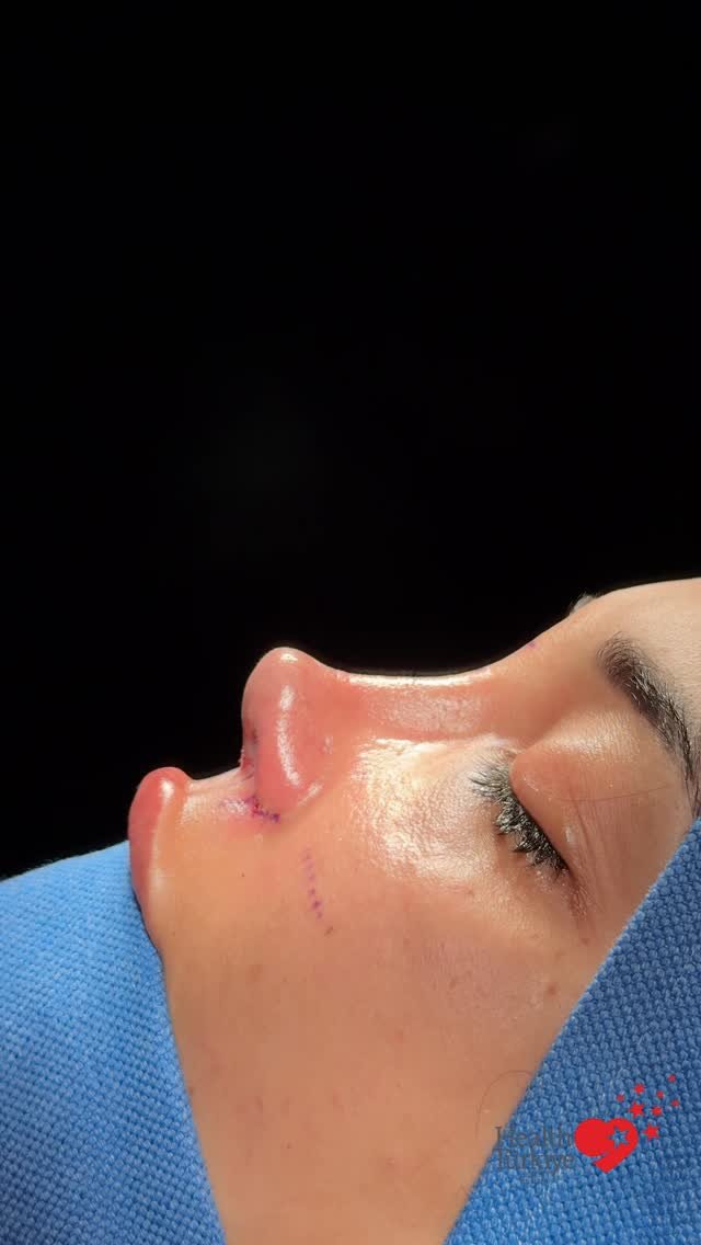drfurkanozer 게시물 이미지: Dr. Furkan Özer Clinic is an international...