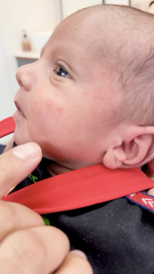 drimranpatelofficial 게시물 이미지: Neonatal acne. #drimranpatel