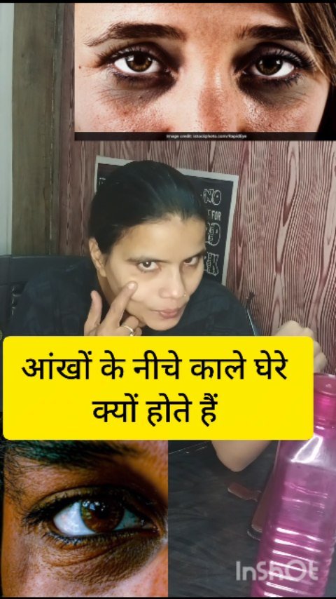 drx_sonu2028 게시물 이미지: आंखों के नीचे काले घेरे क्यों हो जाते...