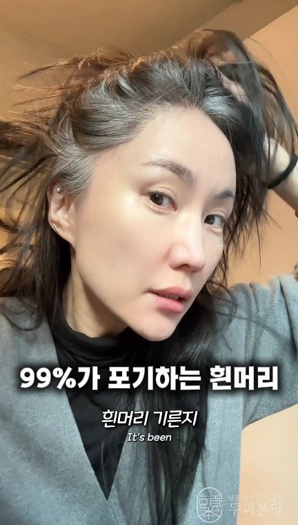 dupibondang 게시물 이미지: 이놈에 흰머리는 왜이렇게
빨리 자라는걸까요

이전에 고잉그레이 발레아쥬 경험...
