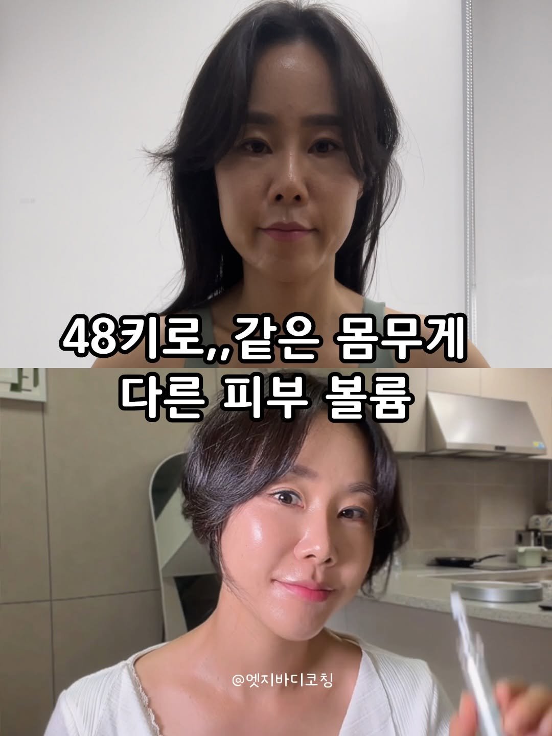 edgebody_belly 게시물 이미지: 볼륨은 타고나는게 아니라 관리해야해요~~
제가 필러랑 지방이식을 싫어하는 이유는 그...