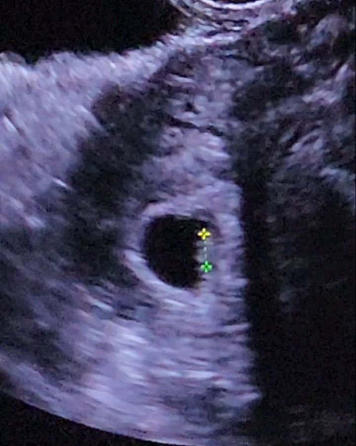 eenicorn 게시물 이미지: 🦄 제가 엄마가 되었습니다...👶👨‍👩‍👧❤

작년 여름 임신 사실을 알고, 꽃피는...