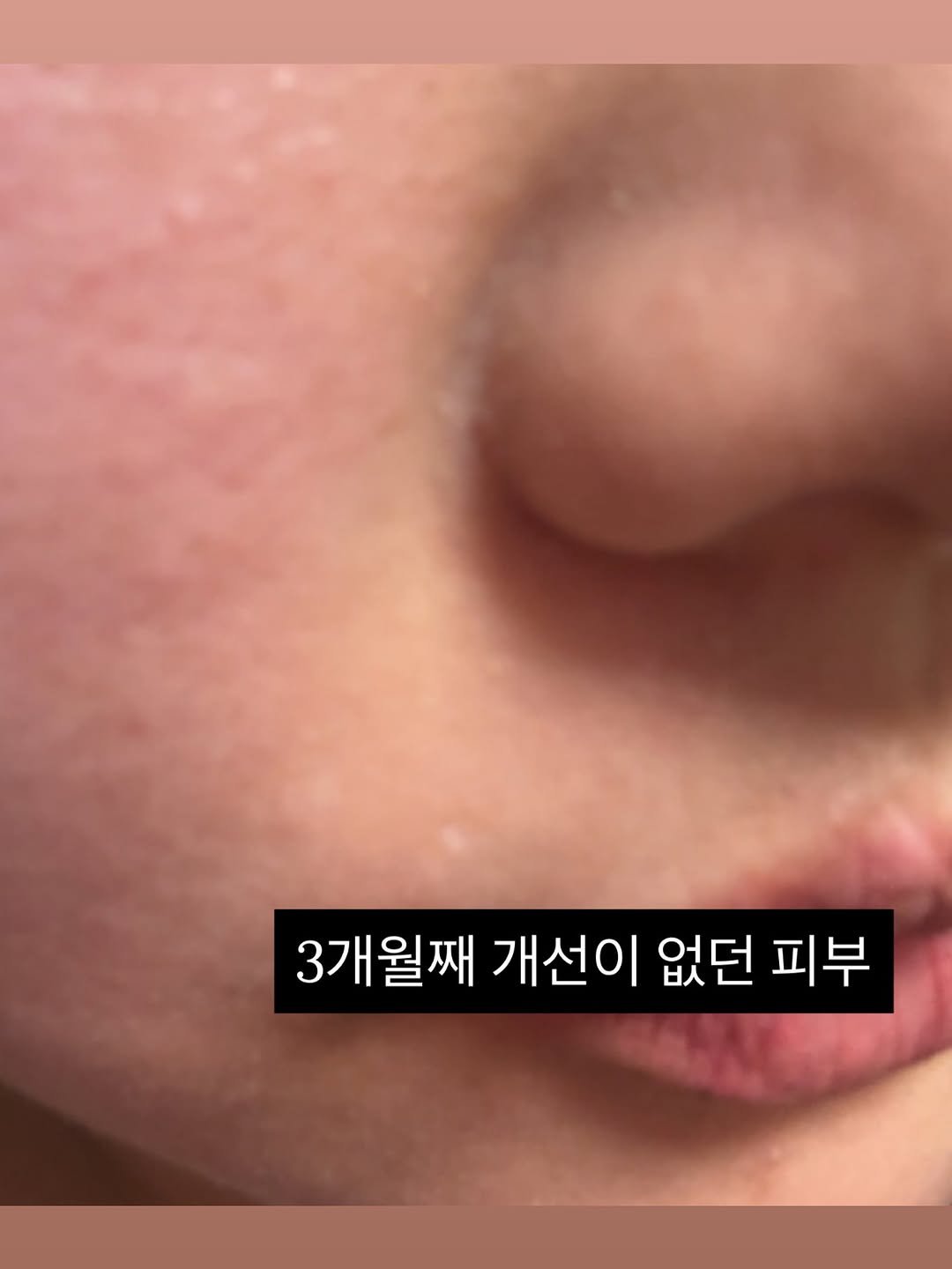 egmz86 게시물 이미지: 📍전문가 코칭을 받아야 하는 이유
(공구제품처럼 내맘대로 골라서...