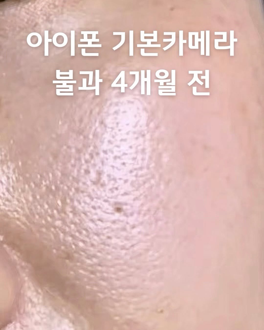 egmz86 게시물 이미지: 마흔 넘고 평생 처음만나는 망가진 피부를 보았어요

나이 드니까 한번 커지고...