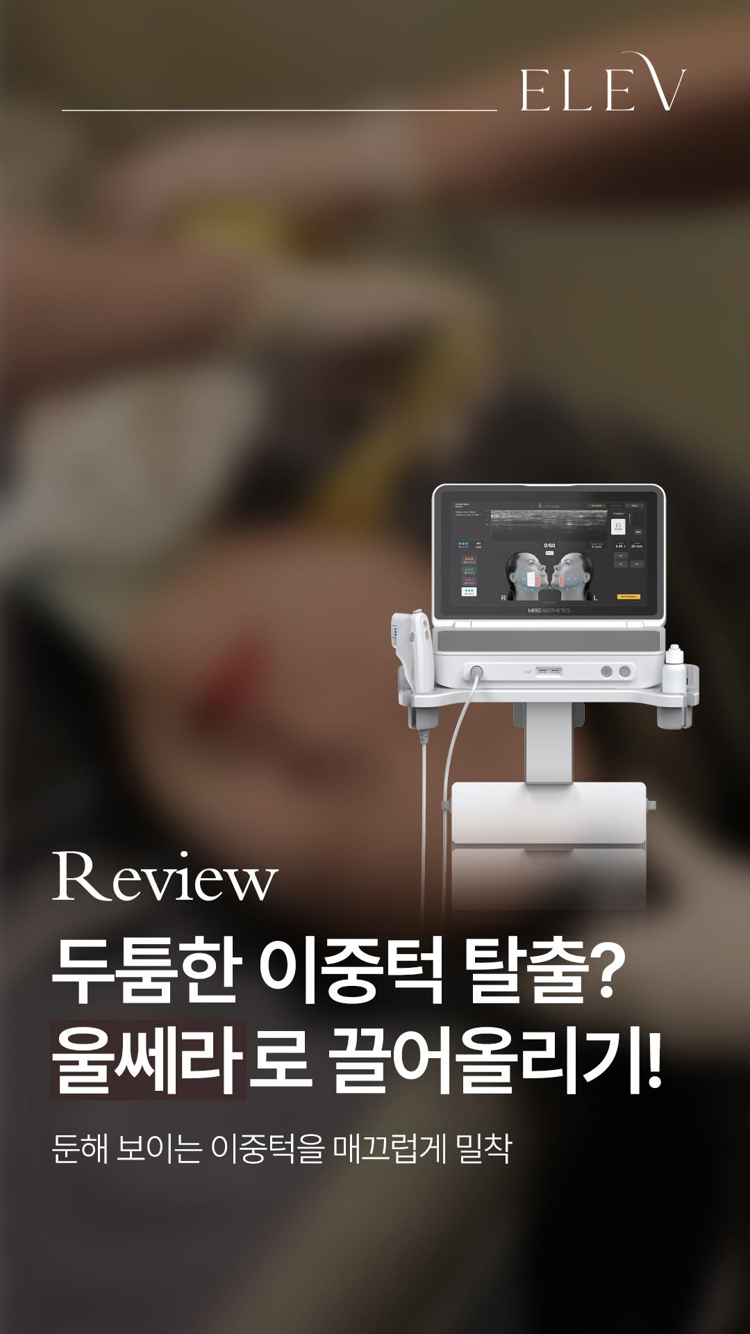elevclinic 게시물 이미지: 처진 이중턱 고민? 울쎄라피 프라임으로 확실하게 끌어올리기!
#울쎄라...