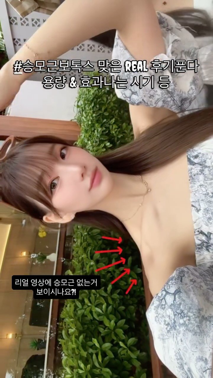 ellefit_.uri 게시물 이미지: 한평생 승모근이 컴플렉스였던 나.....
메이필클리닉에서 #승모근보톡스...