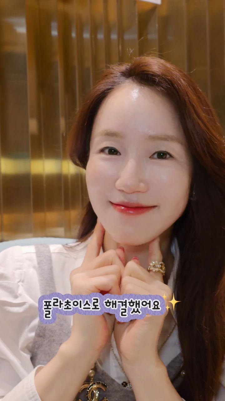 ellen_lee627 게시물 이미지: #광고 신경 쓰이던 팔자주름, 레티치올로 달라졌어요✨...