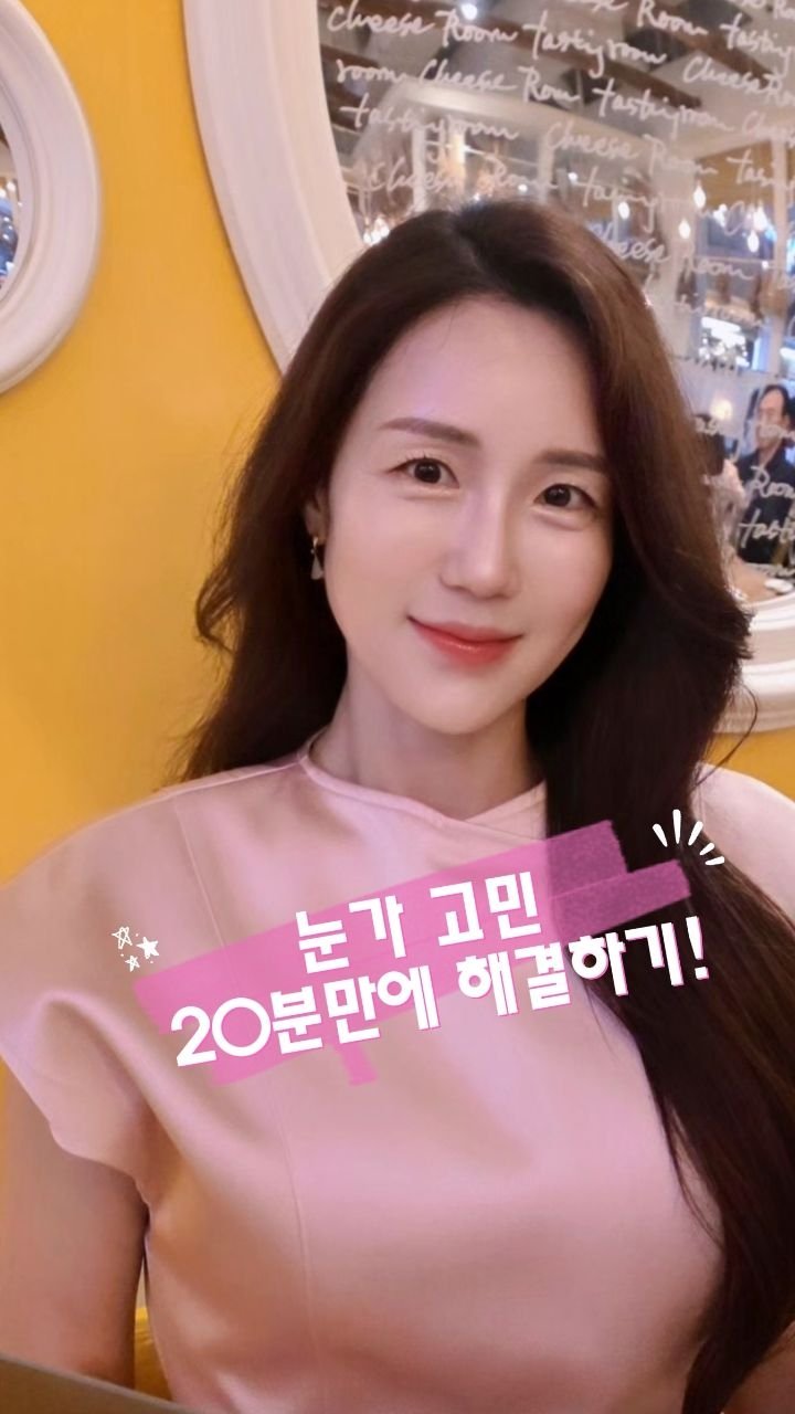 ellen_lee627 게시물 이미지: 고민되는 눈가주름! 버츄아이로 해결 했어요😉✨️ 눈가 시술이라 효과 있을까? 티...
