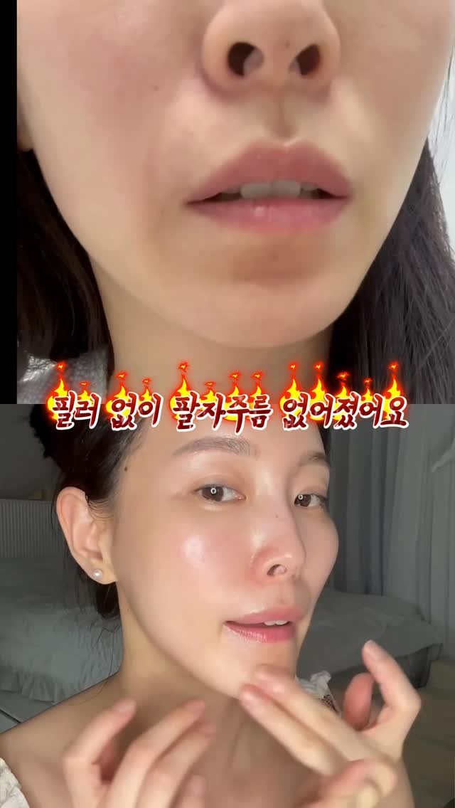esthetia_songdo_sh 게시물 이미지: 🔥드디어 오늘 저녁10시 라방! 
윤곽조각술 프로스핀 왜이리 인기가 많은지!! 왜...